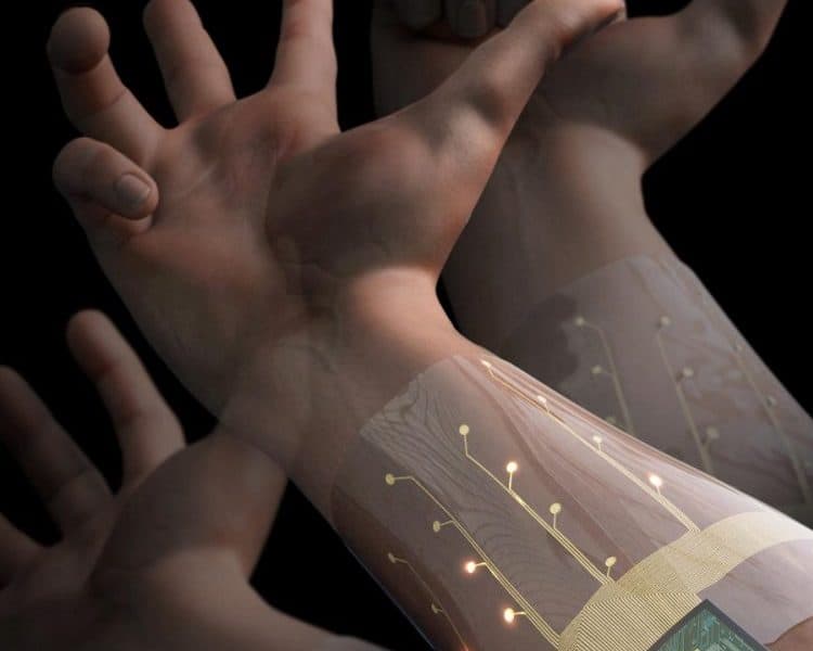 UCL AI-supported wearable device could support prosthetics use