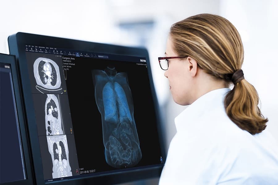 sectra NHS trust goes live with new diagnostic imaging initiative