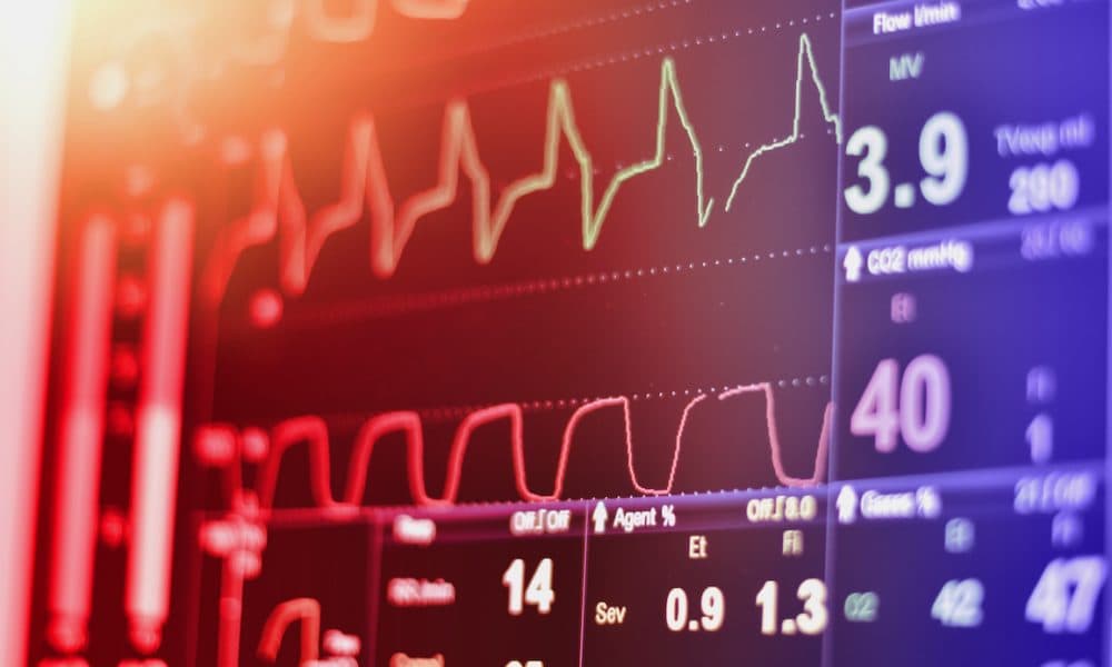 Sales of cardiac devices fall victim to global pandemic in the US