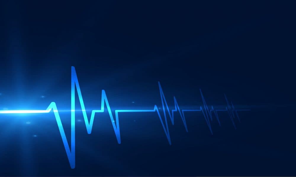 Portable ECGs pioneered in mental health