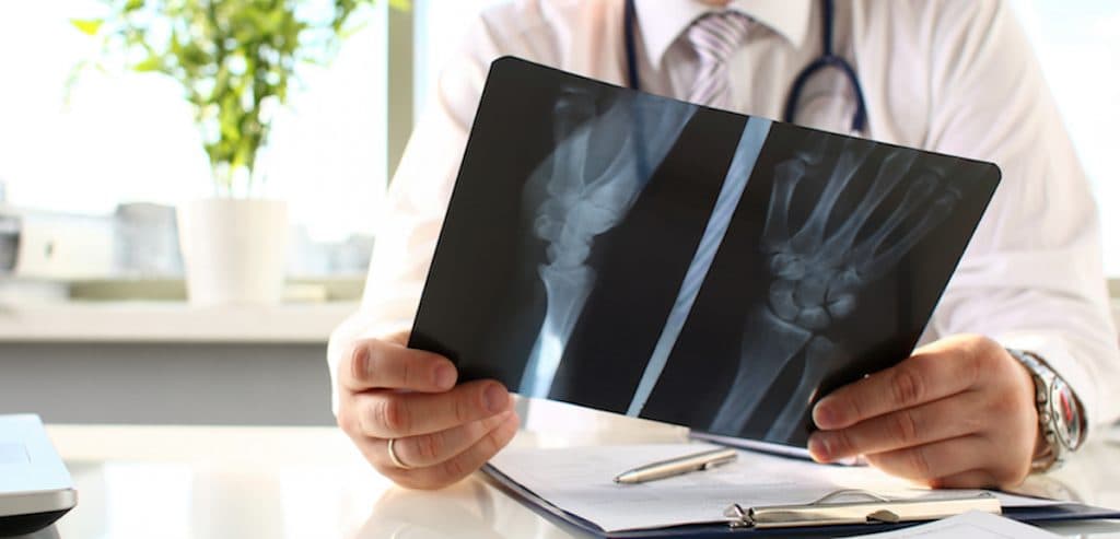 x-ray