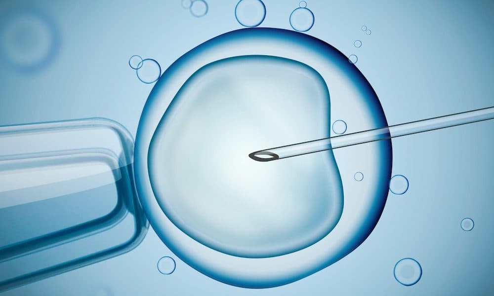 Laboratory,Microscopic,Research,Of,Ivf,(in,Vitro,Fertilization).,Digital,Illustration. Overture backed by further $15m for IVF work