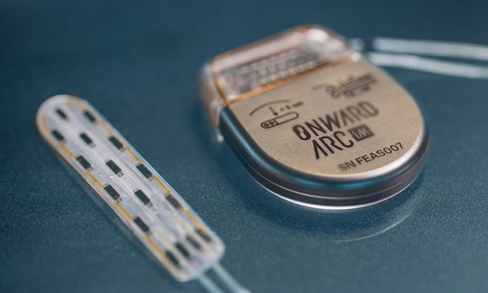 ONWARD secures latest boost on road to commercialisation