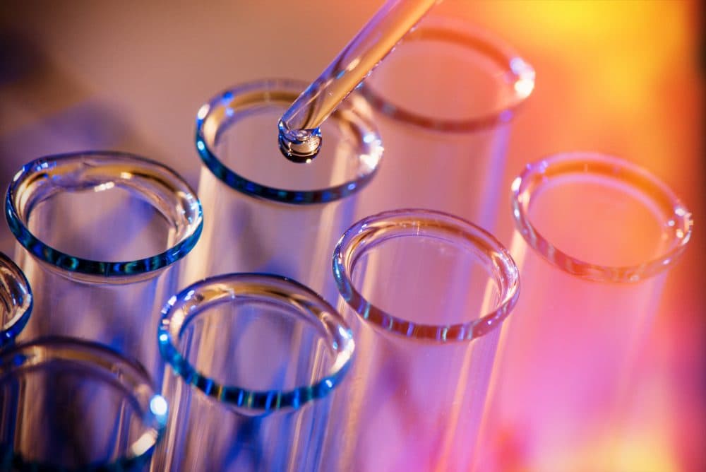 Test tubes ina. row with a dropper placing liquid in one for a bacteria test on urine to test for a UTI