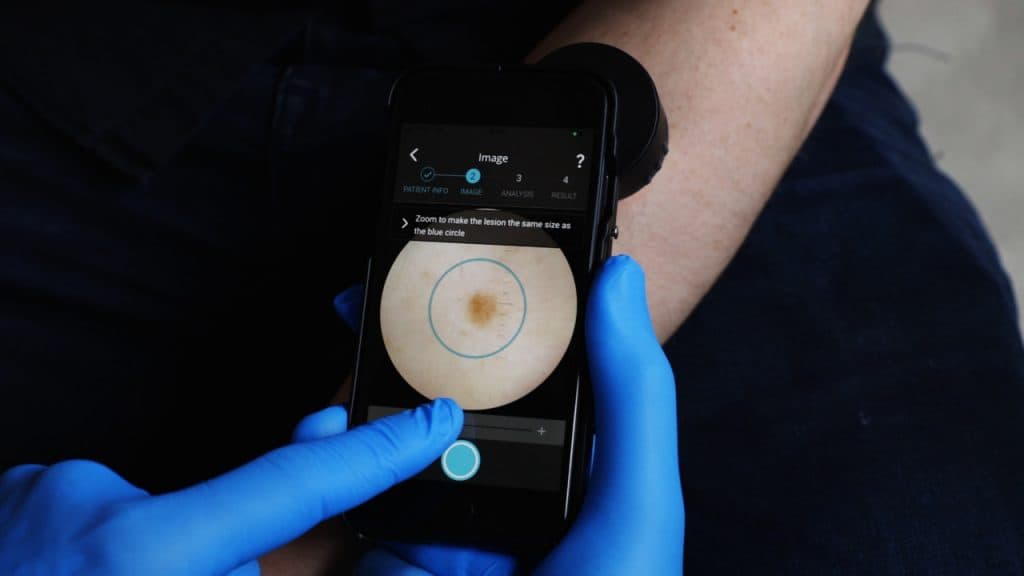 Dermalyser