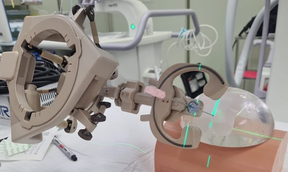 AI-enabled robot supports doctors in kidney stone surgery