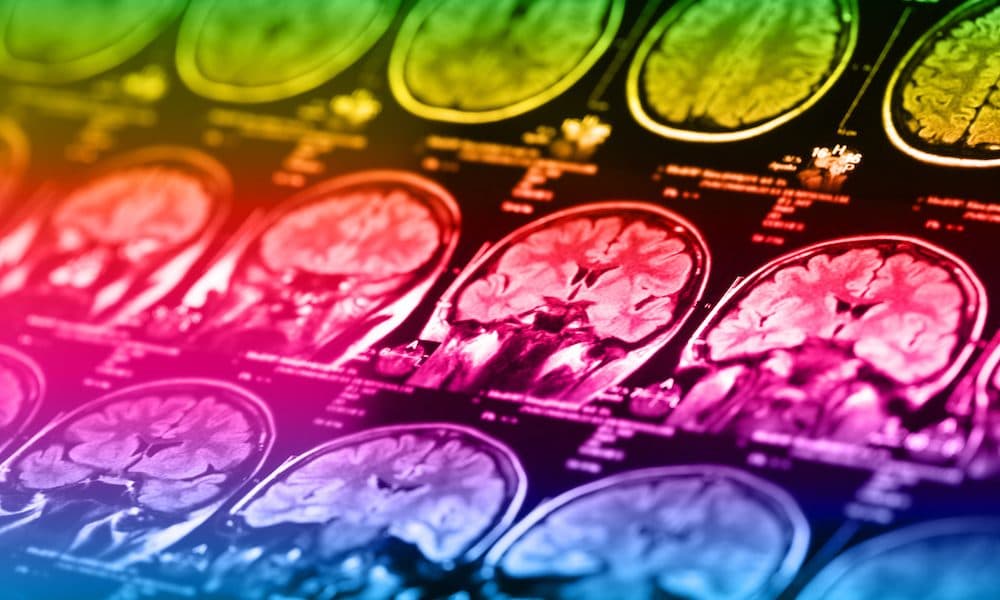 Brain scans remarkably good at predicting political ideology