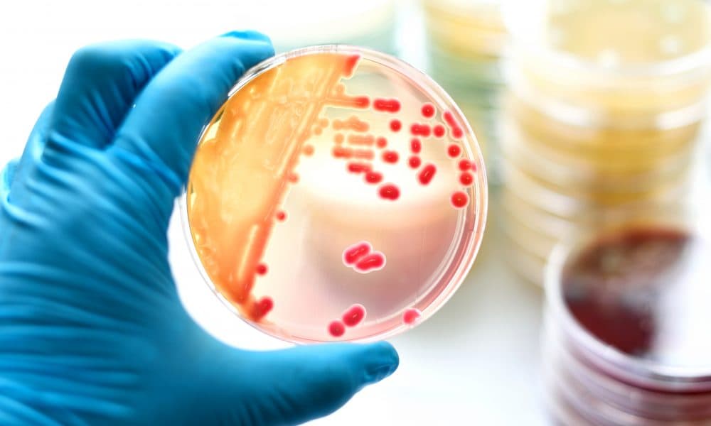 Groundbreaking results reveal AI can reduce sepsis deaths