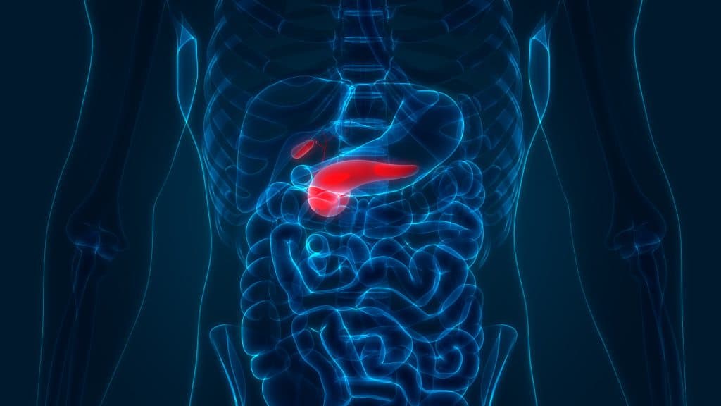 Pancreatic cancer