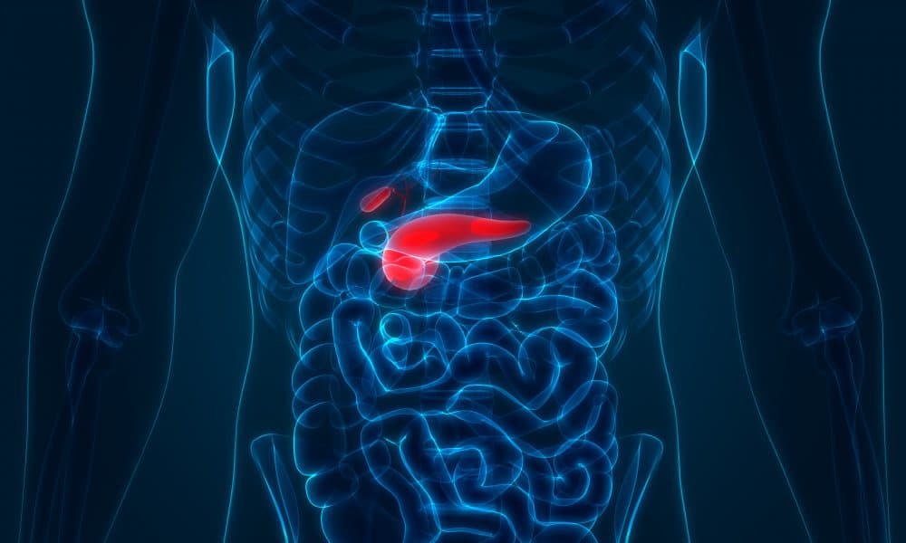 Pancreatic cancer immune map provides clues for precision treatment targeting