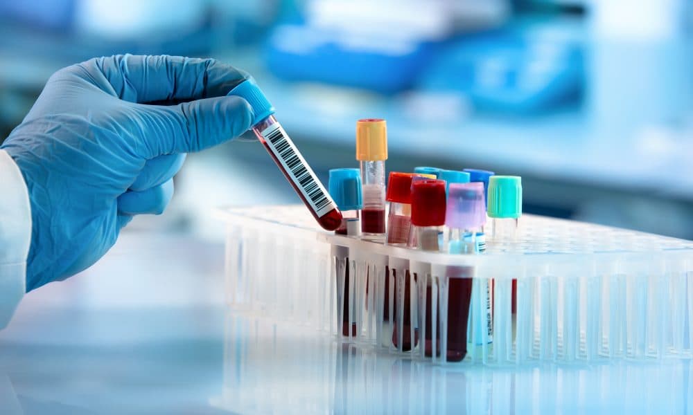 New blood test could be an early warning for child diabetes