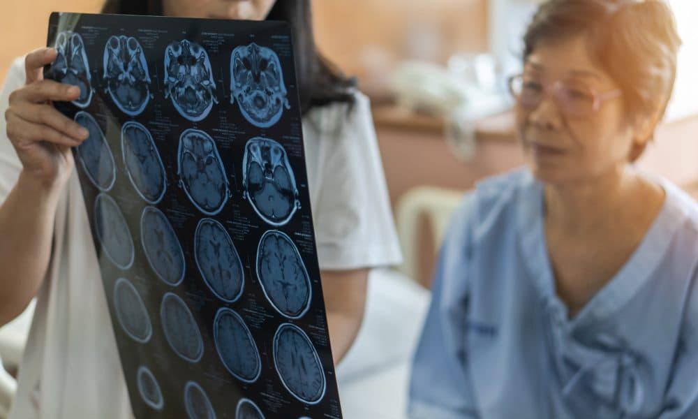 Stroke diagnosis and the race to curb a growing epidemic