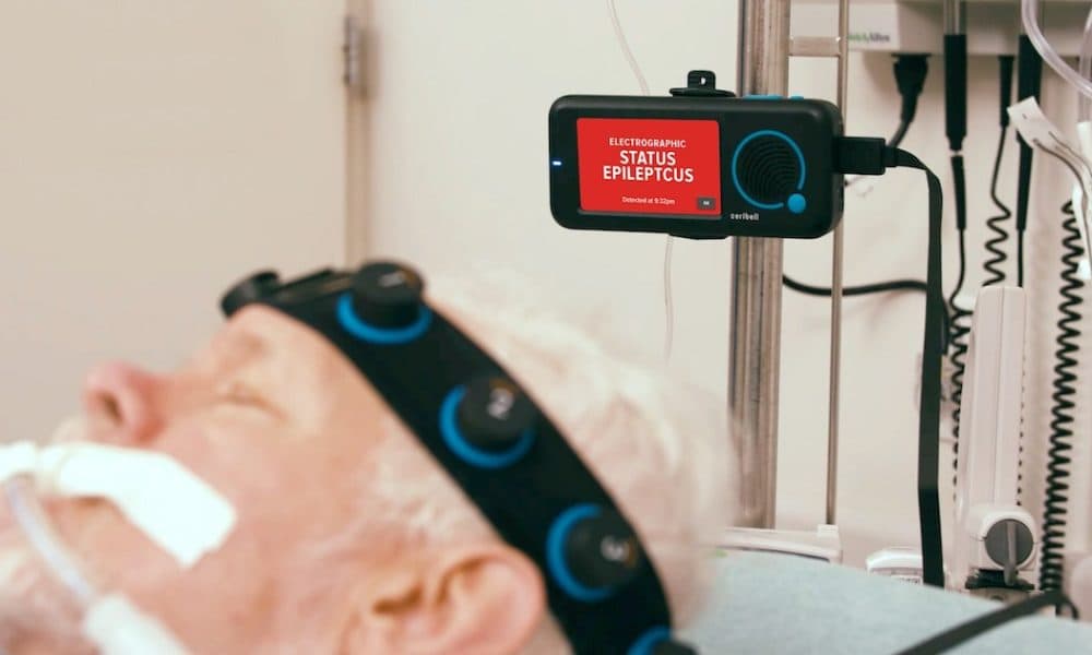 Ceribell brings power of AI to seizure management