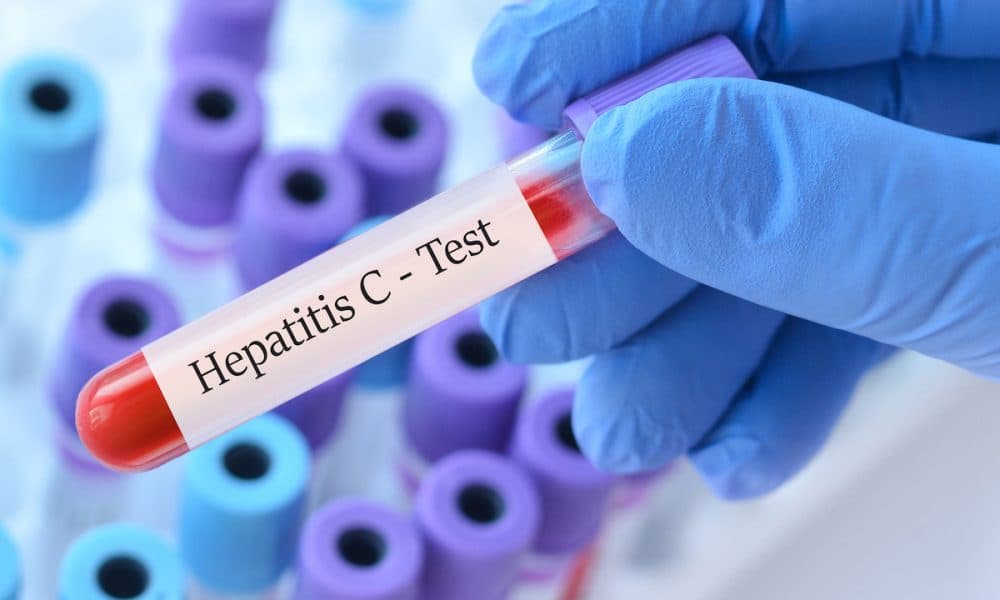 AdobeStock_623017408 Innovative vaccine design provides new hope in fight against Hepatitis C