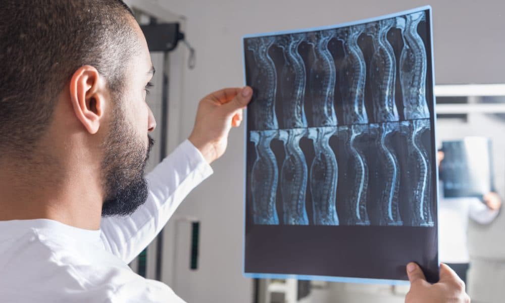 AdobeStock_216512844-1 ‘Wraparound’ implants represent new approach to treating spinal cord injuries