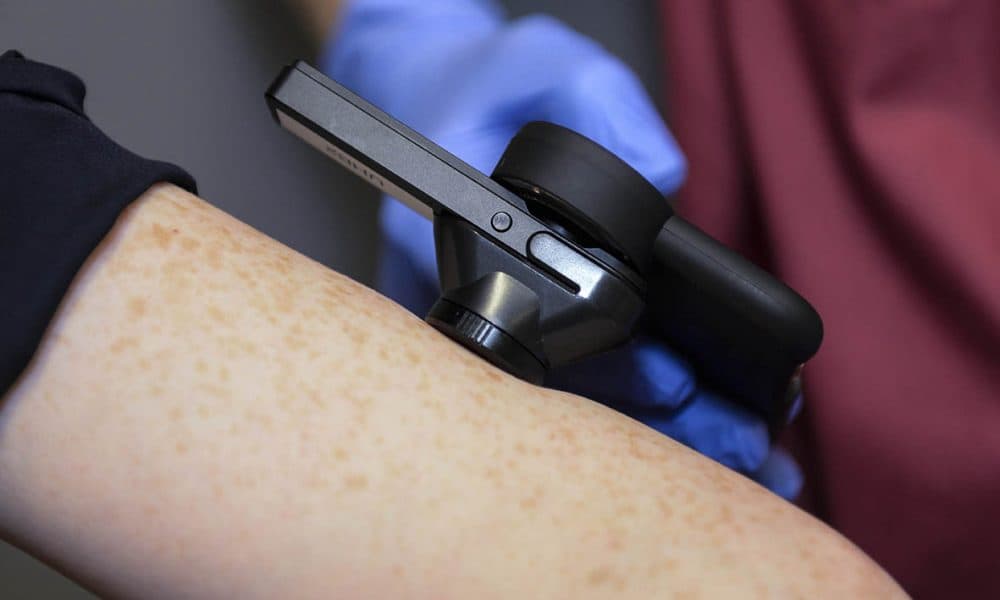 NHSE-Edge-Report_Skin-Analytics-Teledermatology-Project_Clinical-Photography-5-r AI shown to outperform human experts for skin cancer detection