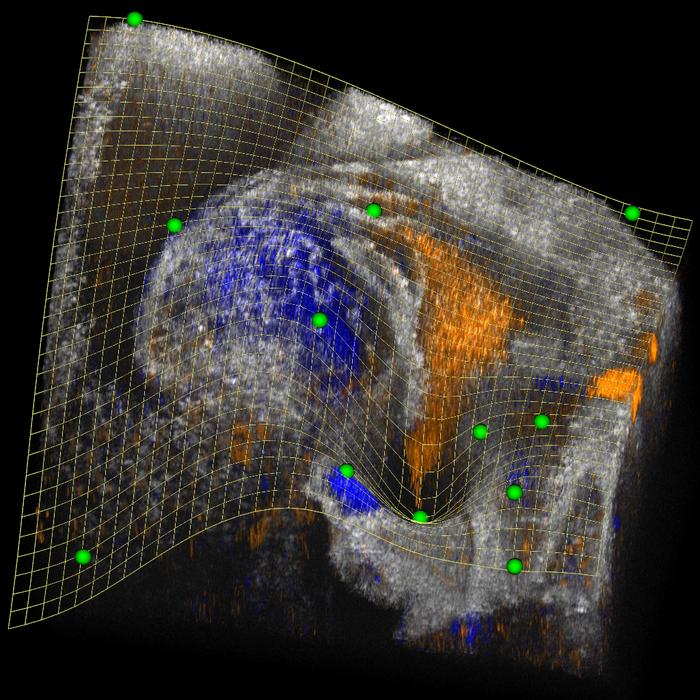 Low-Res_Image_ClippingSpline_BloodFlow A new view inside complex 3D biomedical images