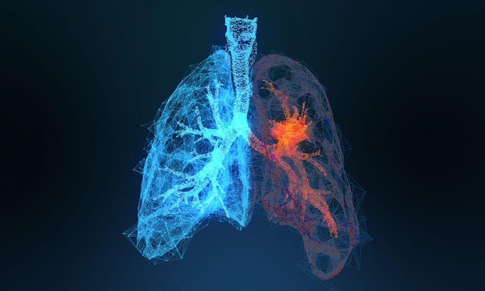 AdobeStock_296280067-1000×600 Qureight tech deployed in lung fibrosis clinical trial