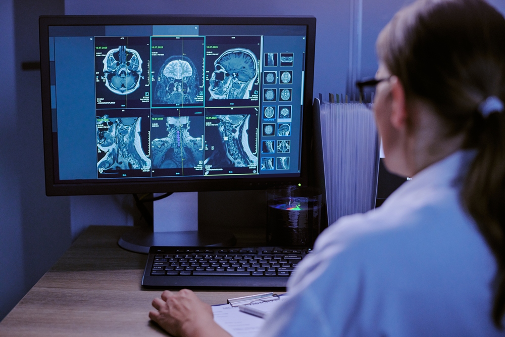 Caucasian Female Doctor Analyzing Brain and Spine Mri Scans on Computer Monitor AI will make medical scan reports twice as easy for patients to understand – study