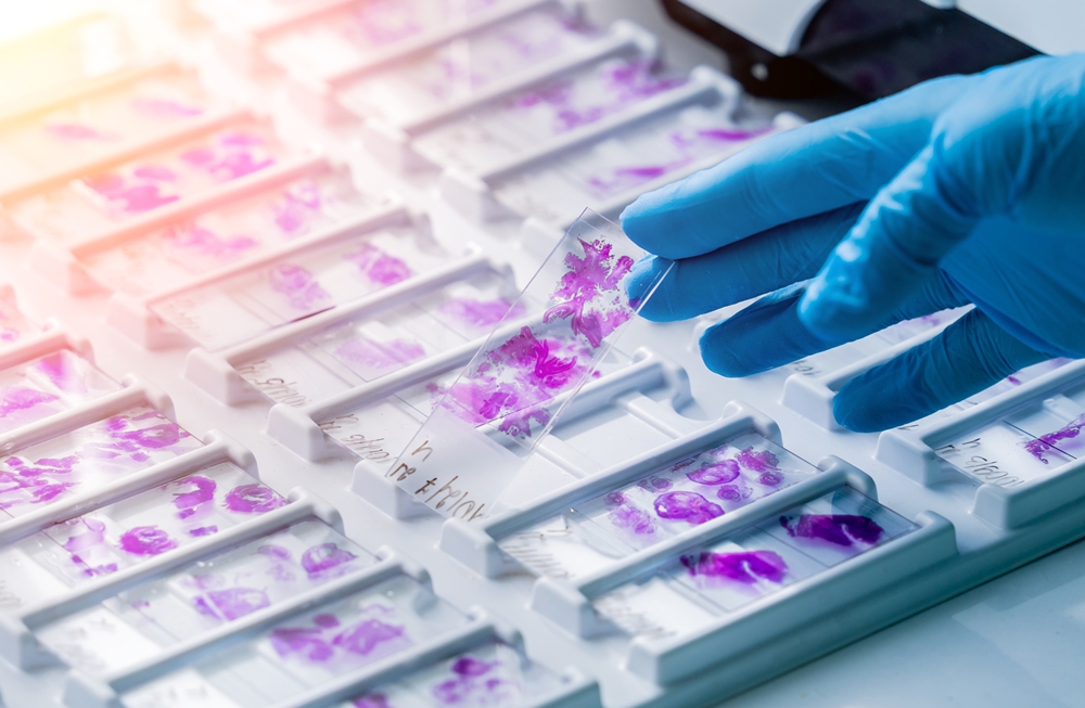 What a karyotype actually shows: when it’s offered, and what it can and can’t tell you